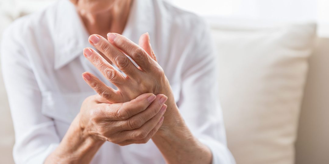 Arthritis