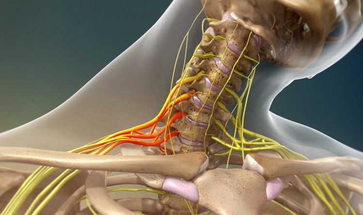 Brachial Plexus Injury
