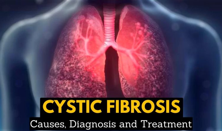 Cystic Fibrosis