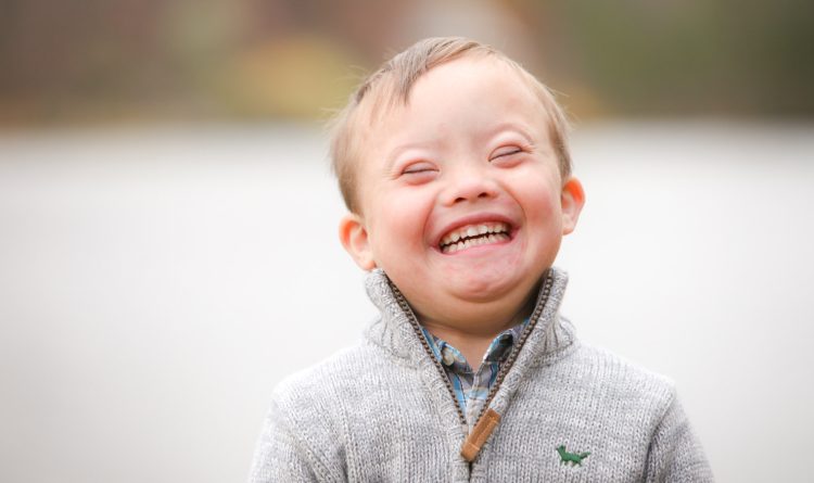 Down Syndrome