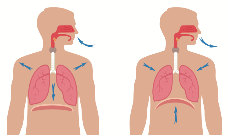 Dysfunctional Breathing Pattern