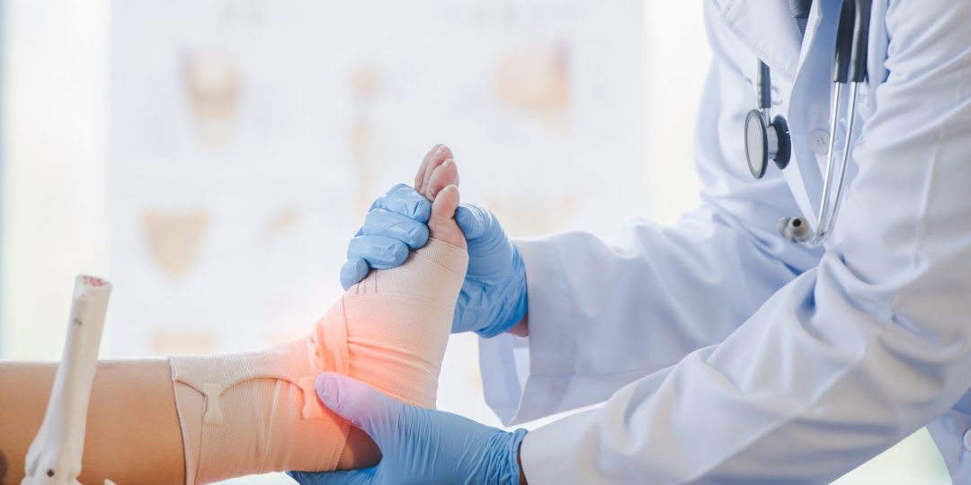 Close-up of pictures of a male orthopedic doctor or orthopedic doctor Wear a medical mask and medical gloves. Going to analyze the cause of ankle bone degeneration In his office at the hospital