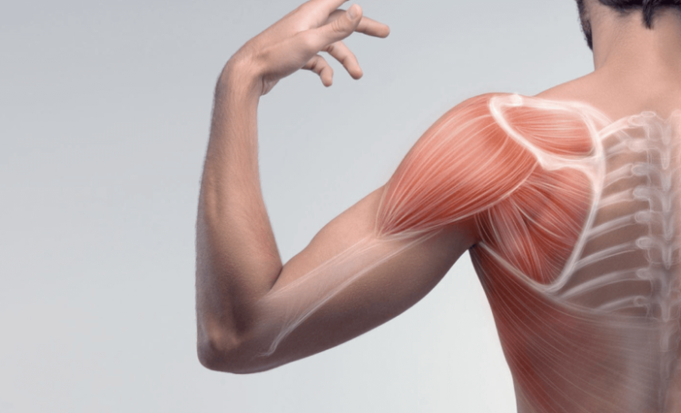 Muscle Strain