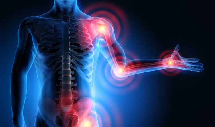 Musculoskeletal