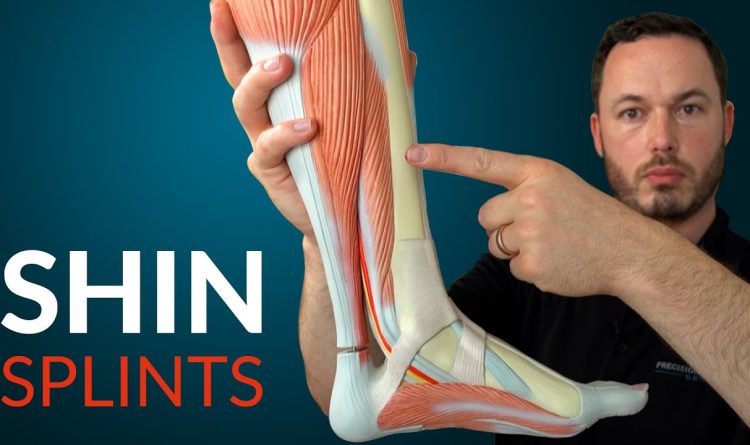 Shin Splints