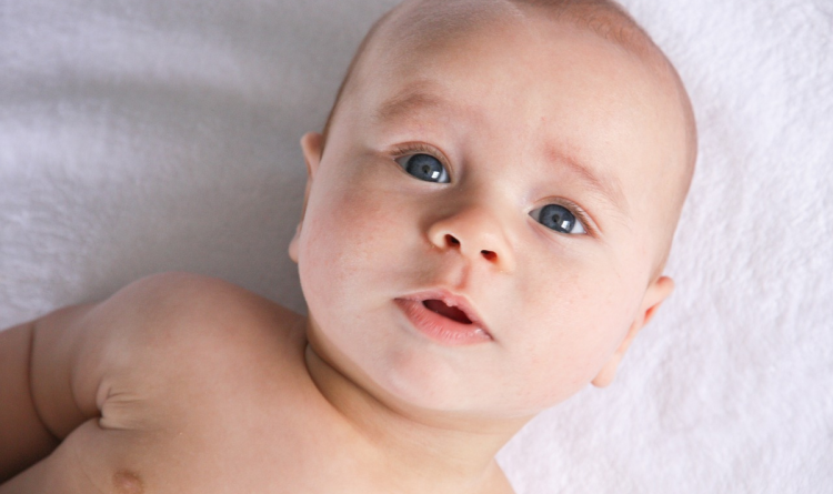 Torticollis
