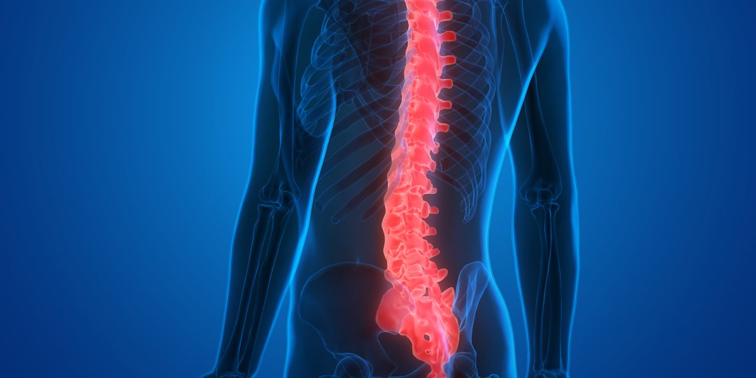 spinal trauma